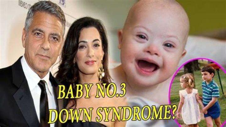 Does Alexander Clooney Have Down Syndrome? A Comprehensive Exploration