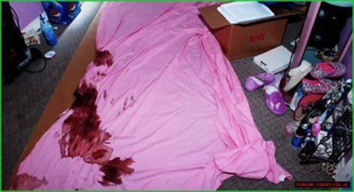 Understanding The Controversy Surrounding Deedee Autopsy Photo